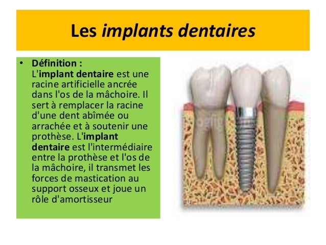 hygiene dentaire definition hygiene dentaire definition